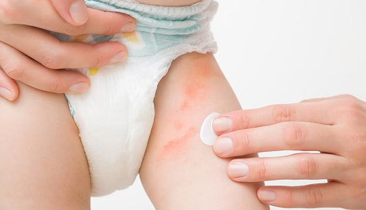 What to use to wash baby bottom with diaper rash?