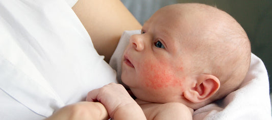What if my baby has eczema or sensitive/dry skin—what wash is best?