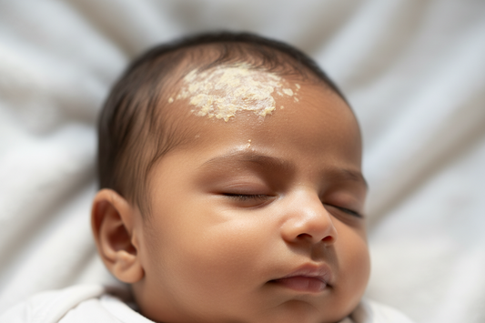 Best Baby Shampoo For Cradle Cap In India — Ingredients That Actually Help