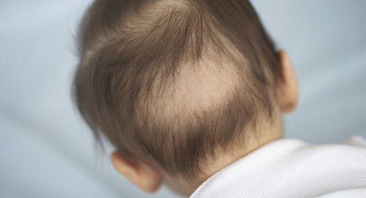Can Baby Shampoo Reduce Hair Loss?